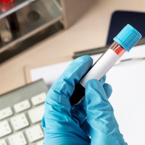 Νέες οδηγίες για την έλλειψη σιδήρου: Αλλάζουν τα όρια της φερριτίνης για έγκαιρη διάγνωση