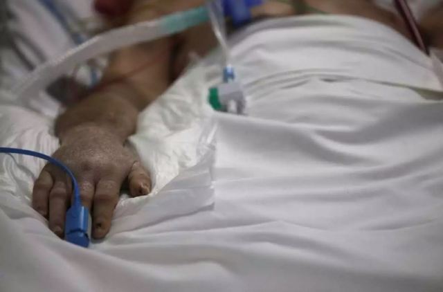 ΕΟΔΥ: Ένα το περιστατικό λέπρας – Η νόσος είναι ιάσιμη