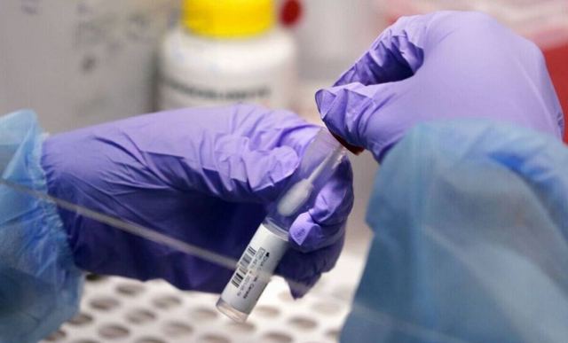 Κορωνοϊός: 9.308 κρούσματα σήμερα και 176 επαναλοιμώξεις - Στους 334 οι διασωληνωμένοι, 57 νέοι θάνατοι