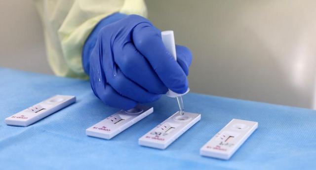 Κορωνοϊός: 4.782 κρούσματα σήμερα με 486 επαναλοιμώξεις - Στους 180 οι διασωληνωμένοι, 18 νέοι θάνατοι