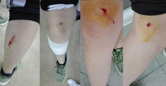 Επίθεση σκυλιών σε δρομέα στο Ισαδάκι Λαμίας