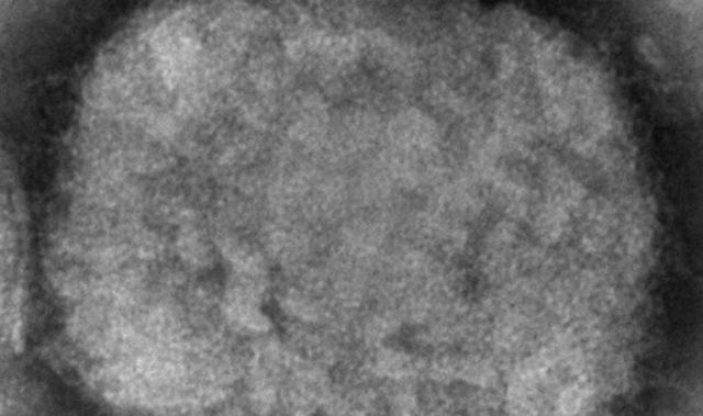 Ευλογιά των πιθήκων: Ανησυχία σε Ευρώπη και Βόρεια Αμερική - Τα συμπτώματα της σπάνιας ασθένειας, πώς μεταδίδεται