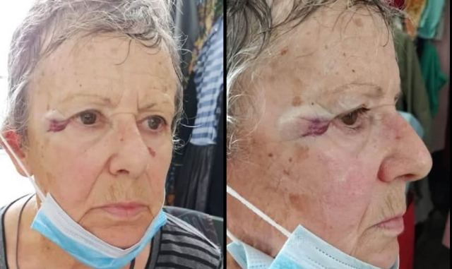 Απίστευτο: Την χτύπησε ο παπάς γιατί πήγε να ταΐσει τα γατάκια στο προαύλιο της εκκλησίας!