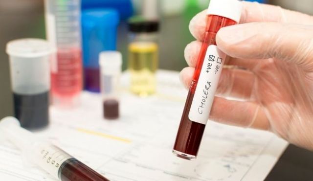 Ισπανία: Εντοπίστηκε το πρώτο μεταδιδόμενο κρούσμα χολέρας από το 1979