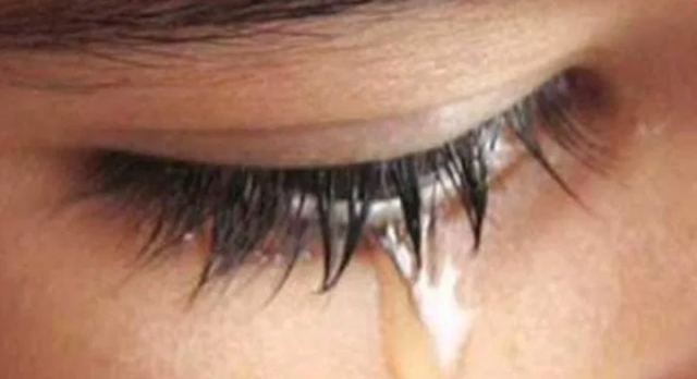 Θρήνος στο Βελεστίνο: Πέθανε η 8χρονη που είχε υποστεί αλλεργικό σοκ