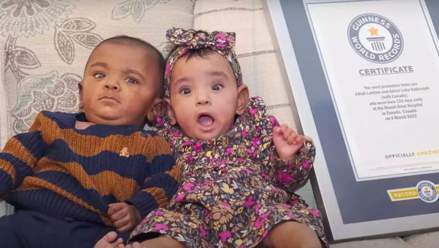 Τα πιο πρόωρα δίδυμα στον κόσμο μόλις μπήκαν στο Γκίνες: Γεννήθηκαν 22 εβδομάδων!