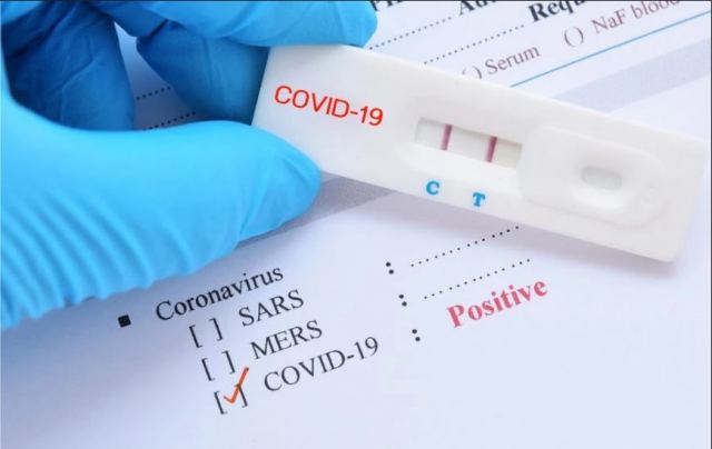 Γιατί ένα τεστ κορωνοϊού μπορεί να βγαίνει θετικό για πολλές μέρες;