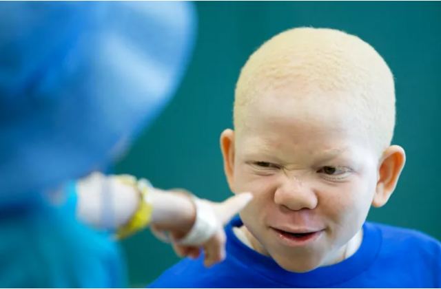 Σοκ: Άνδρας δολοφόνησε τον Αλμπίνο αδελφό του και πούλησε τα μέλη του σώματός του ως γούρια!