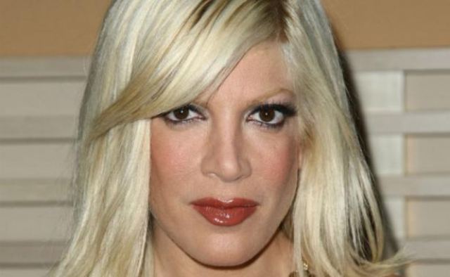 Tori Spelling: Σοκάρουν οι φωτογραφίες του προσώπου της μετά από χημικό πίλινγκ!