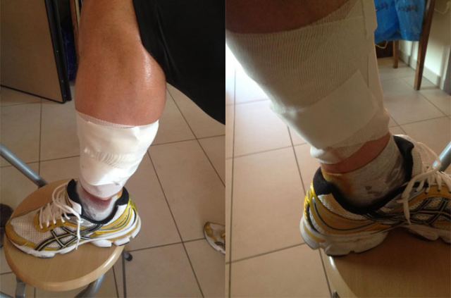 Λαμία: Επίθεση σκύλων σε ποδηλάτη - ΦΩΤΟ