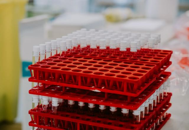 Moderna και Merck ετοιμάζουν εμβόλιο για το μελάνωμα- Σε λίγους μήνες τα αποτελέσματα