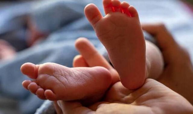 Μωρό γεννήθηκε με δύο κεφάλια, τρία χέρια και δύο καρδιές