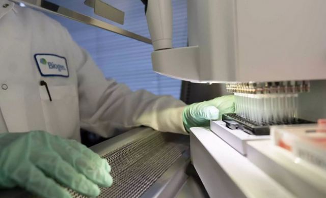 Αλτσχάιμερ: Ανακαλύφθηκε γονίδιο που αυξάνει τον κίνδυνο εμφάνισης στις γυναίκες