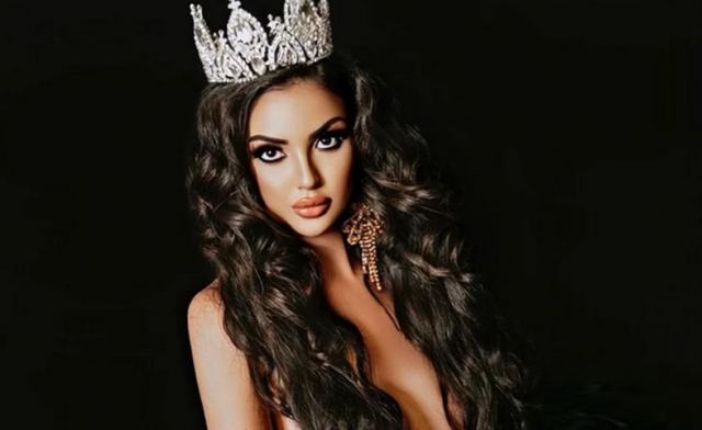 Πλήρωσε 600.000 δολάρια για να μοιάσει στην Κιμ Καρντάσιαν και τώρα δίνει άλλα 120.000 για να αλλάξει