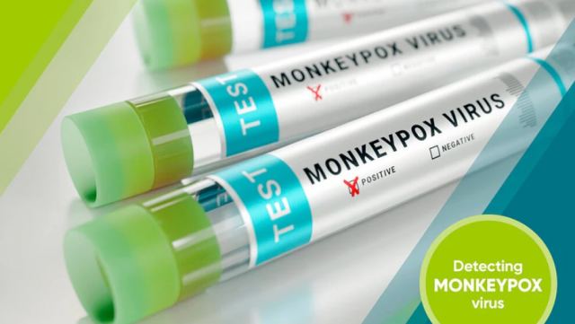 Ευλογιά των πιθήκων: 11 τα επιβεβαιωμένα κρούσματα – Χαμηλός ο κίνδυνος για τον γενικό πληθυσμό