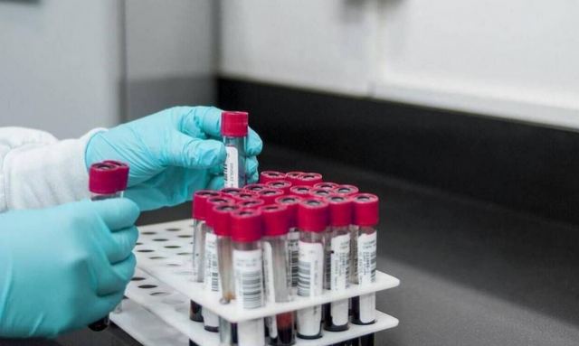 Συναγερμός για τη νόσο Lyme - «Πάνω από το 14% του παγκόσμιου πληθυσμού είναι φορέας»