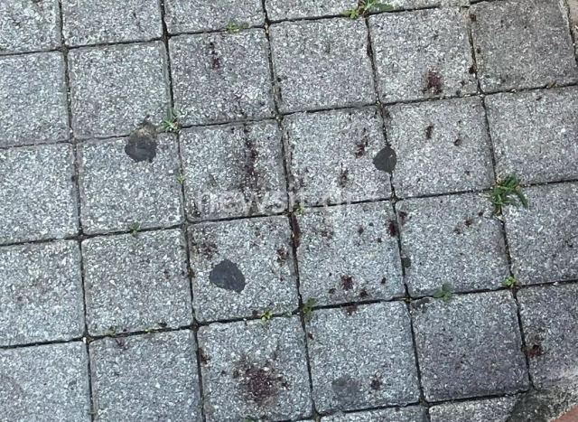 Θεσσαλονίκη: Πυροβόλησαν έξι φορές εν ψυχρώ τον 25χρονο – Περπάτησε αιμόφυρτος για να ζητήσει βοήθεια