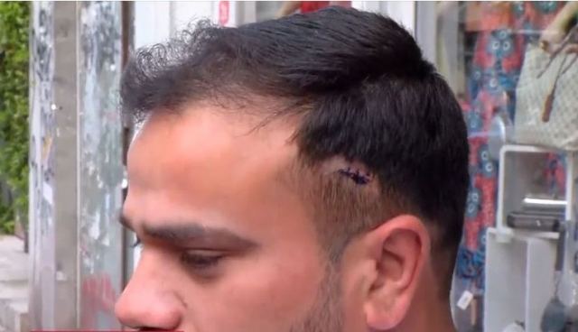 Πατήσια: Οδηγός ταξί πυροβόλησε νεαρό μουσουλμάνο με παραδοσιακή φορεσιά