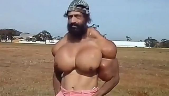 Πέθανε ο Βραζιλιάνος «Hulk» – Έκανε ενέσεις λαδιού για να «φουσκώσει» τους μύες του