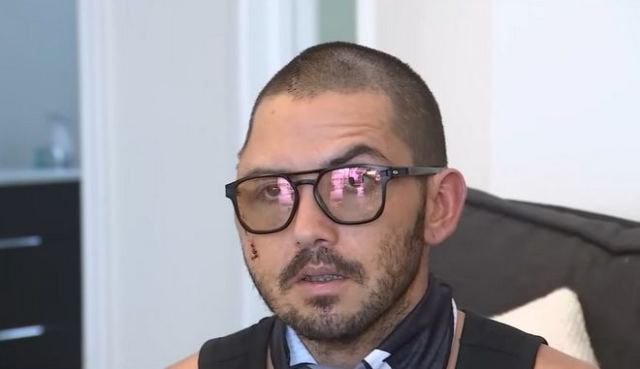 Τρομακτικό βίντεο: Άνδρας επέζησε από επίθεση αλιγάτορα - Αφαίρεσαν μέρος του κρανίου του