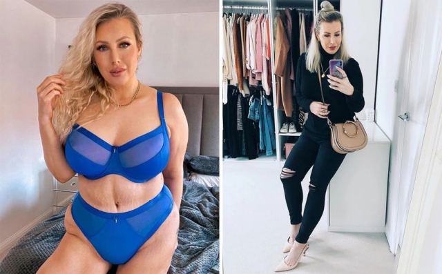 Αποφάσισε ότι είναι ευτυχισμένη με τα παραπάνω κιλά αφού πρώτα υποβλήθηκε σε επέμβαση