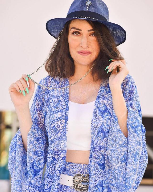 Ιωάννα Παλιοσπύρου: Φωτογραφίζεται σε καλοκαιρινό mood και μάς δείχνει τα σημάδια στο σώμα της