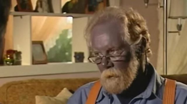 Κι όμως ο «Παπα-Στρουμφ» υπήρξε: Ο άνθρωπος που ήταν μόνιμα μπλε (ΒΙΝΤΕΟ)