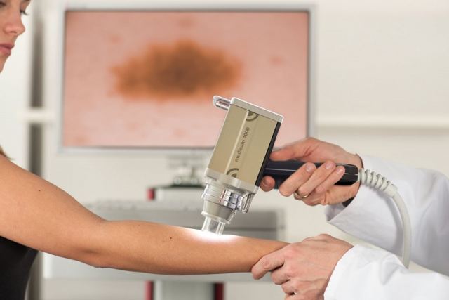 Μύθοι και αλήθειες για το μελάνωμα