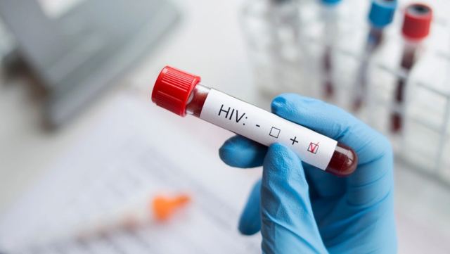 Ιατρικό θαύμα: 66χρονος στην Καλιφόρνια θεραπεύτηκε από το AIDS