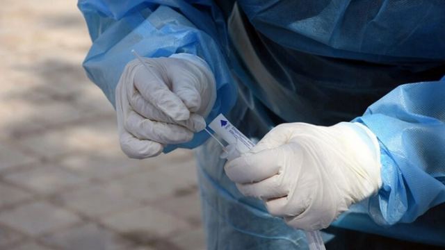 Κορωνοϊός: 4.626 κρούσματα σήμερα με 494 επαναλοιμώξεις - Στους 161 οι διασωληνωμένοι, 19 νέοι θάνατοι