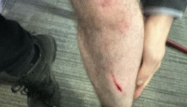 Τυφλός δημοσιογράφος ορμάει σε επίδοξο ληστή και παίρνει πίσω το κινητό του