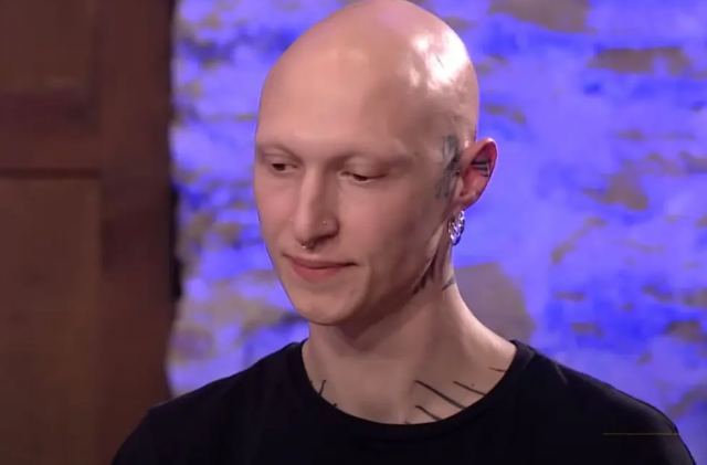 MasterChef: Συγκίνησε ο υποψήφιος με την αλωπεκία – «Ξύπνησα την άλλη μέρα και τα μισά μαλλιά μου ήταν στο κρεβάτι»