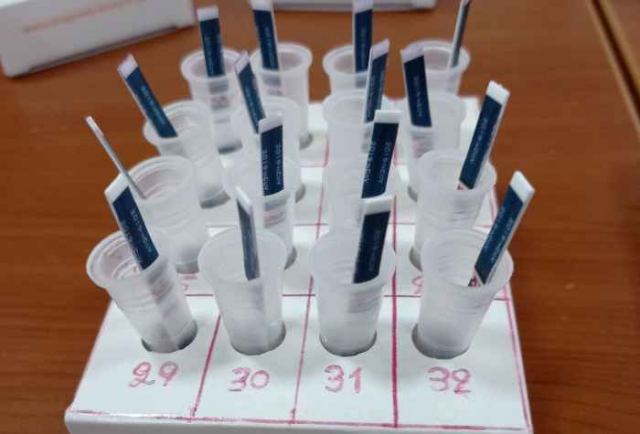 Τι έδειξαν τα rapid tests στο Δήμο Λοκρών