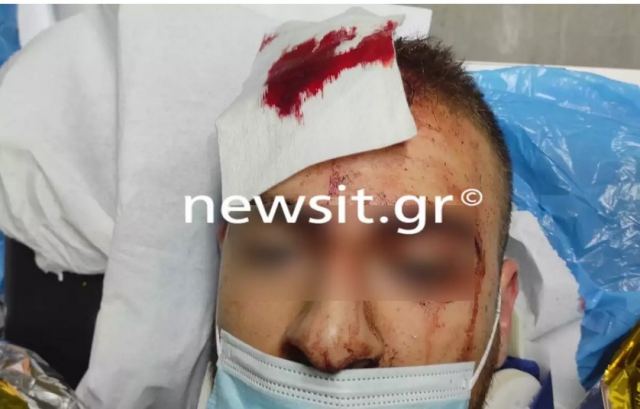 Allou! Fun Park: Από την αντλία νερού προκλήθηκε το ατύχημα – Τι λέει ο 25χρονος τραυματίας