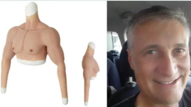 Ο Ιταλός που έβαλε ψεύτικο χέρι για να αποφύγει το εμβόλιο λέει τώρα ότι τον... κατέστρεψαν οι δημοσιογράφοι!