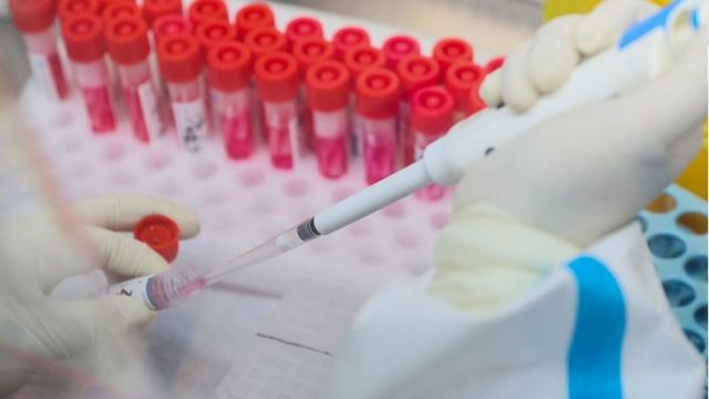 Ευλογιά των πιθήκων: Τα τέσσερα βασικά και αναπάντητα έως τώρα ερωτήματα που έχουν οι επιστήμονες