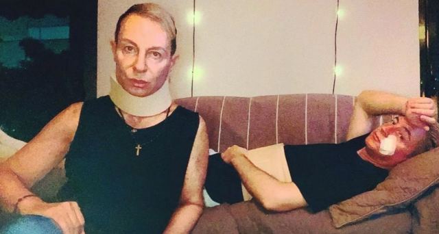 Βασίλειος Κωστέτσος: Δείχνει φωτογραφία από τον τραυματισμό του μετά την επίθεση στο Σύνταγμα