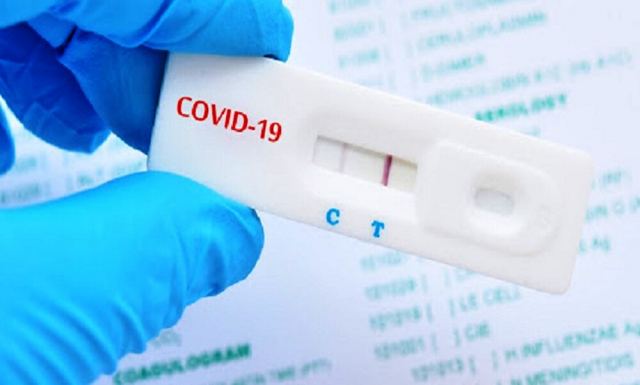 Κορωνοϊός: 15.690 κρούσματα σήμερα και 362 επαναλοιμώξεις - Στους 356 οι διασωληνωμένοι, 64 νέοι θάνατοι