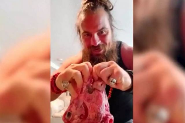 Τρώει καθημερινά ωμό κρέας και κολπικές εκκρίσεις και δηλώνει πιο υγιής από ποτέ