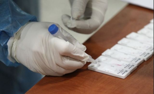 Κορωνοϊός: 33.590 κρούσματα, 129 θάνατοι και 101 διασωληνωμένοι την προηγούμενη εβδομάδα