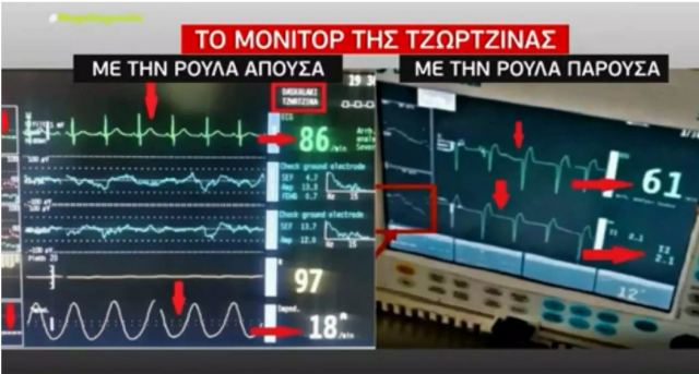 Ρούλα Πισπιρίγκου: Παρατεταμένη χορήγηση κεταμίνης ή δεύτερης ουσίας στη Τζωρτζίνα