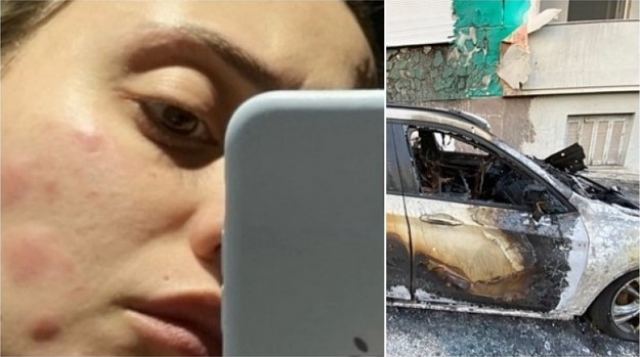 Η εξομολόγηση της Άννας Κορακάκη για το  stalking! - «Παλεύω με μετατραυματικό στρες και ψυχοσωματικά νοσήματα»