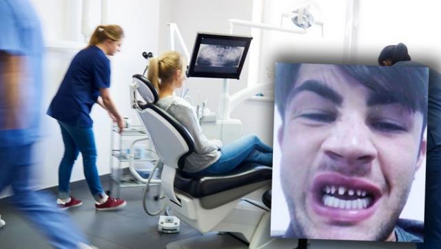 Βρετανία: Σάλος με τα «δόντια Τουρκίας» - Πολίτες επιστρέφουν στη χώρα με πόνους και επιπλοκές